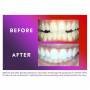 Colgate Optic White ComfortFit Kit de Blanqueamiento Dientes LED y Bolígrafo Blanqueador